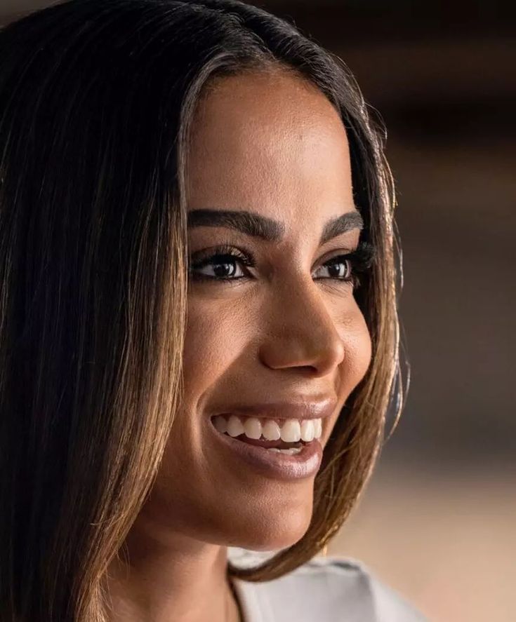 Dents anitta avant et apres transformation hollywood smile