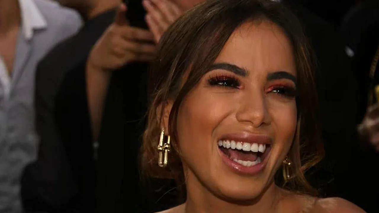 Arcade dentaire d'Anitta et esthetique du sourire