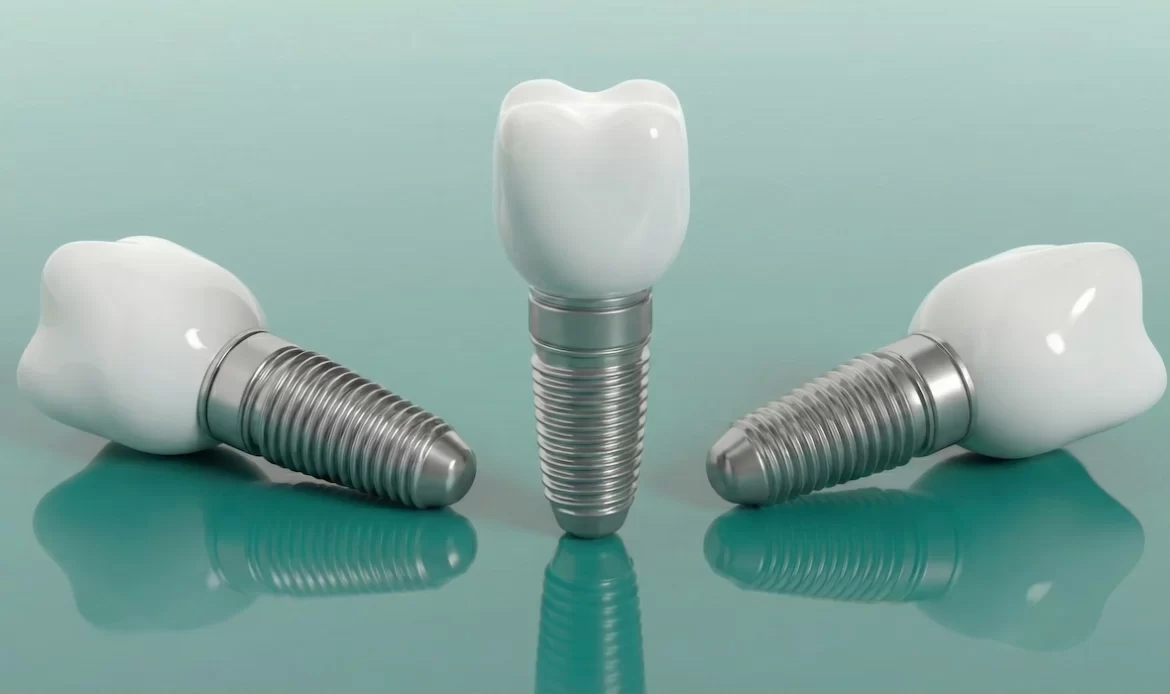 analyse comparative prix implant dentaire usa vs turquie