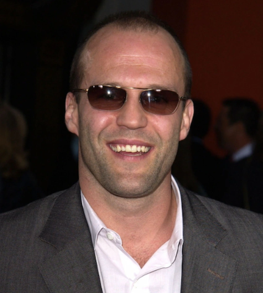 Dents de Jason Statham au début de sa carrière en 2003 montrant un alignement dentaire naturel
