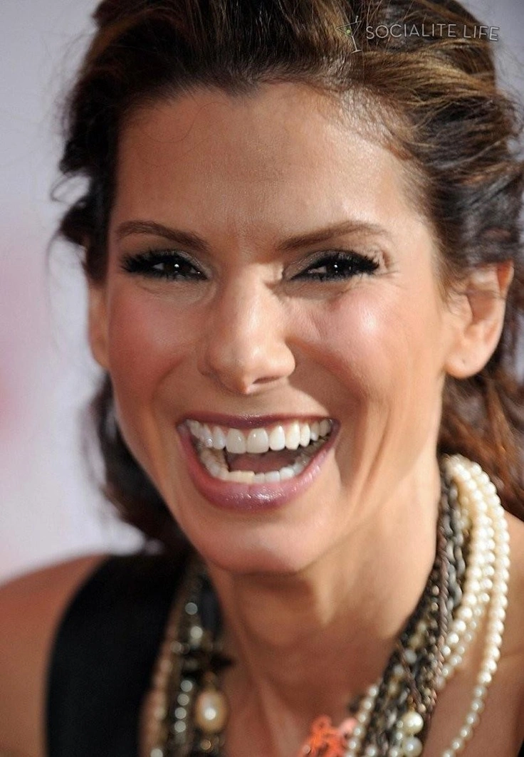 Structure des dents de Sandra Bullock avant les traitements cosmétiques avancés en 2014