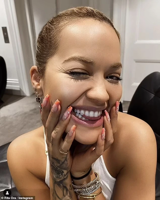 Dents de Rita Ora en 2023 montrant l'alignement parfait des facettes en porcelaine