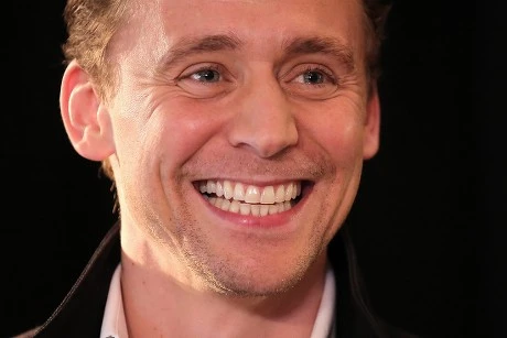 Tom Hiddleston Teeth Before and After
