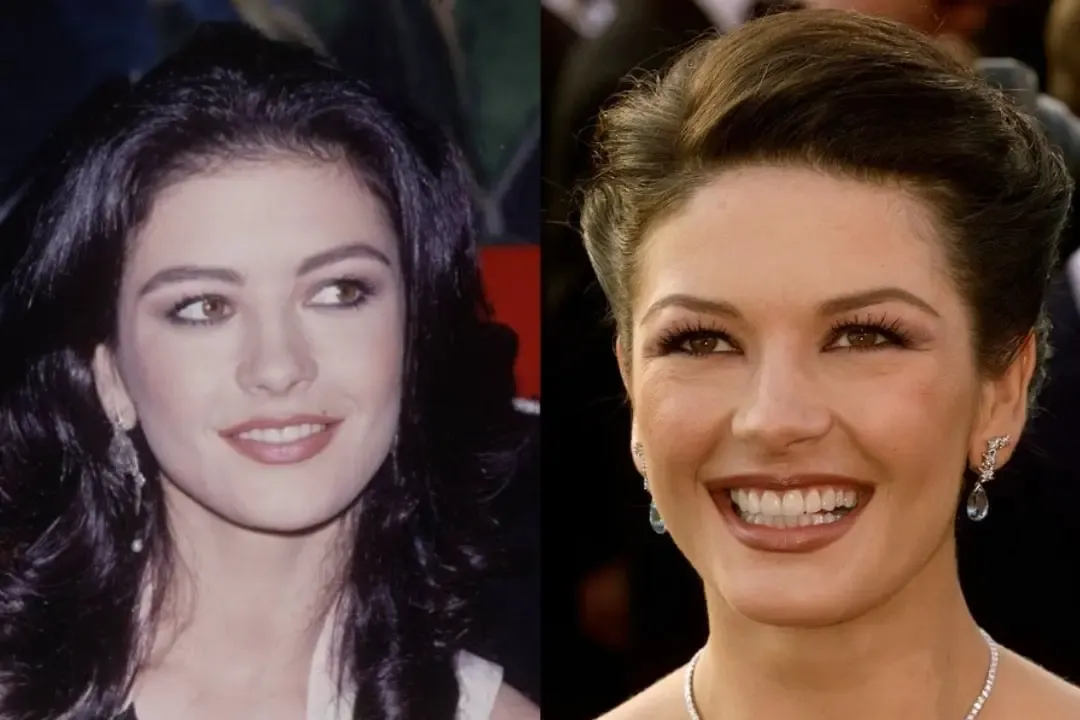 Les dents de Catherine Zeta-Jones avant et après comparaison du relooking esthétique