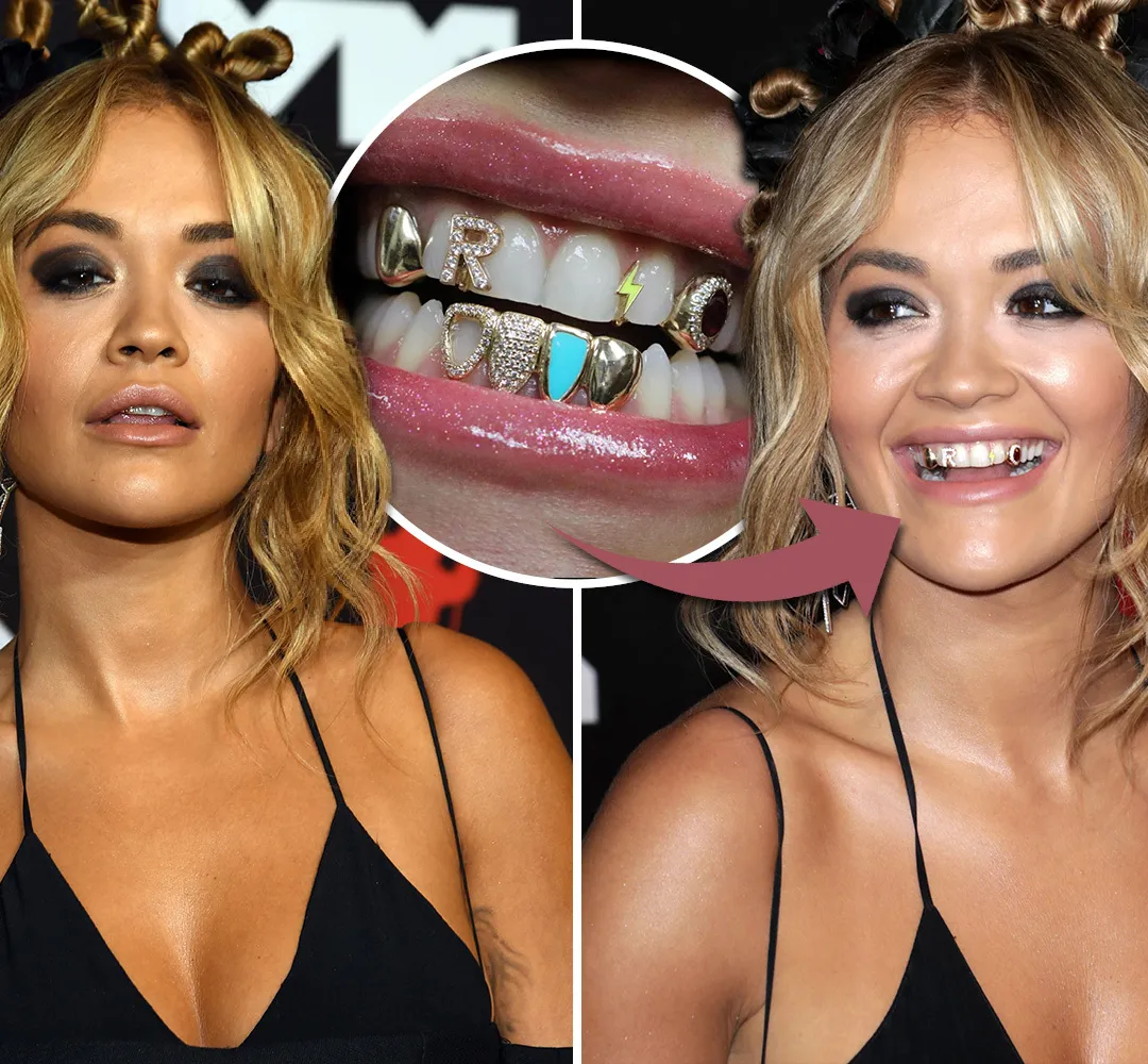 Gros plan sur les dents de Rita Ora montrant la texture de l'email et la translucidite