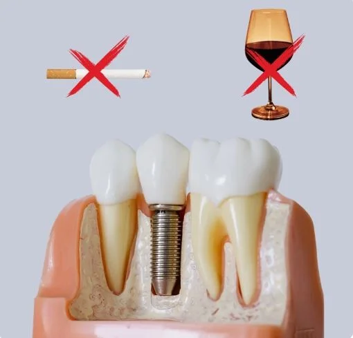 no smoking after dental implant surgery to support healing and implant recovery