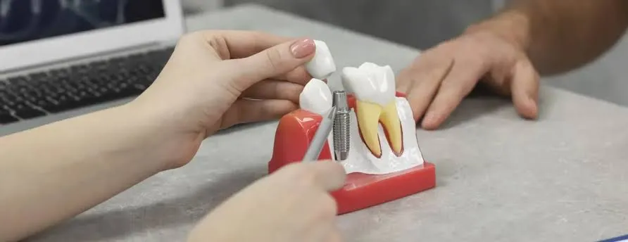 When can you return to work after dental implant surgery recovery timeline