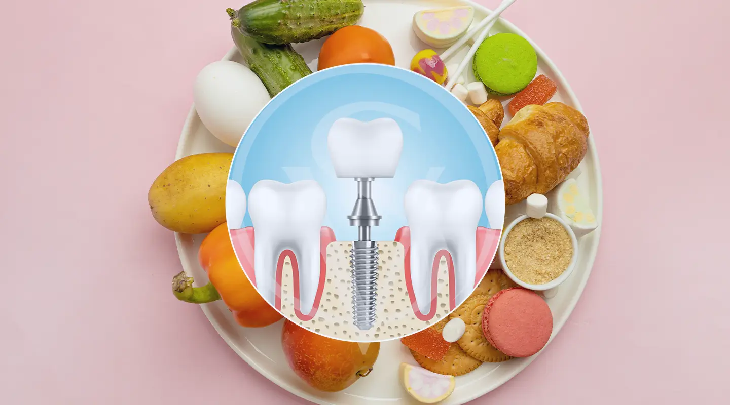 dietary timeline for temporary teeth after dental implant surgery